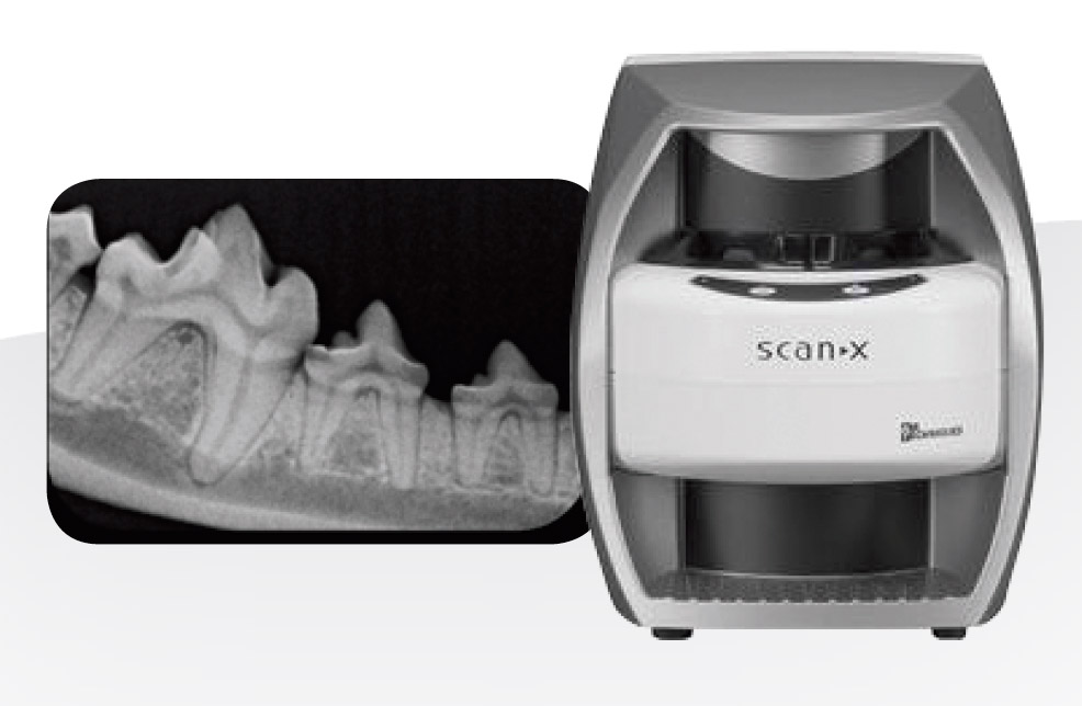 ScanX Duo CR Scanner