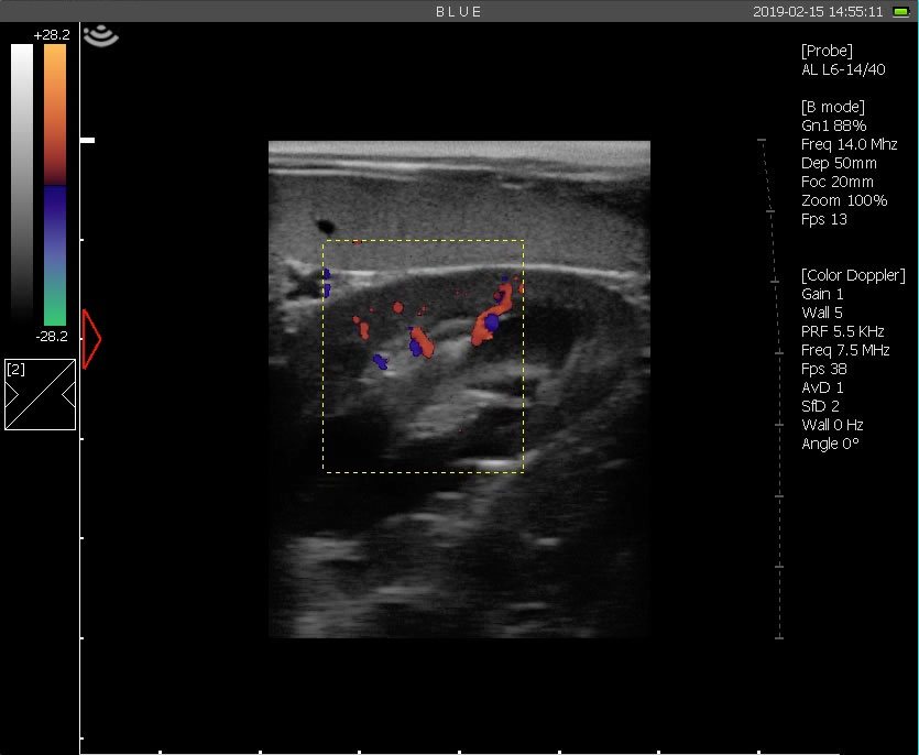 blue-ultrasound-4.jpg