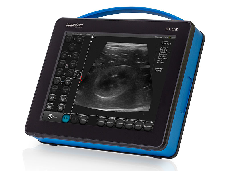 blue-ultrasound.jpg